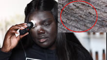 非洲妹子用显微镜看自己的皮肤，放大100倍后，被自己吓到了