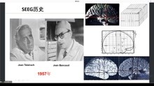 [图]立体定向脑电图临床解析思路step by step