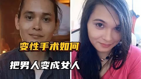 變性手術如何把男人變成女人